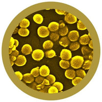 MRSA - Multiresistent Staphylococcus Aurus / Staph och MRSA