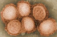 Influensa / Flu / Orthomyxovirus / Influenza / H1N1