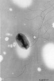 E. Coli (Escherichia coli), / EHEC / ETEC / Urinvägsinfektion (Flera storlekar)