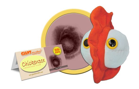Vattenkoppor / vattkoppor / chickenpox / (Varicella-Zoster Virus) - Giant Microbes