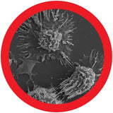 Melanoma / (Magliant neopasm) - giant microbes