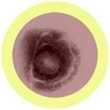 Vattenkoppor / vattkoppor / chickenpox / (Varicella-Zoster Virus) - Giant Microbes
